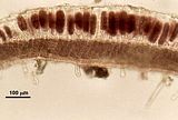 6 - Sezione longitudinale radiale di un nematecio